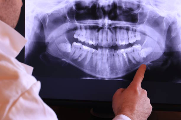 Best Emergency Dental Care for Trauma or Injury in Ledgewood, NJ