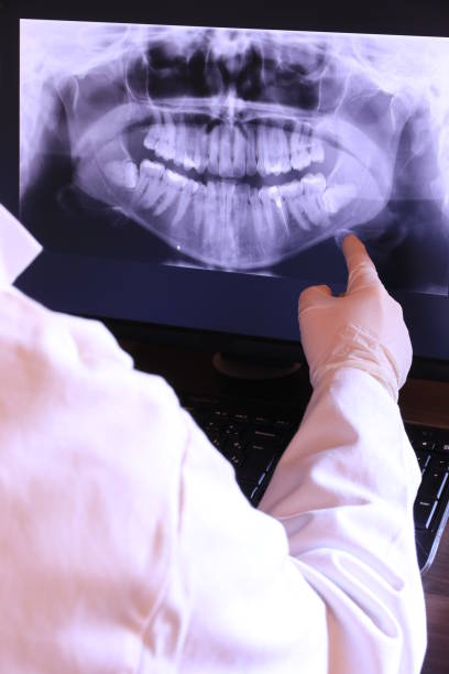 Best Emergency Tooth Extraction in Ledgewood, NJ